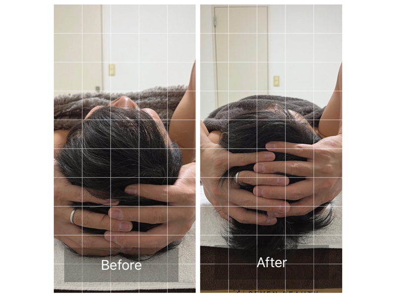 今話題の脳洗浄®が高松で受けられる！オールハンドの施術で驚きのビフォーアフター