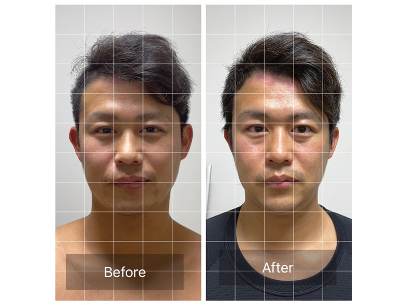 今話題の脳洗浄®が高松で受けられる！オールハンドの施術で驚きのビフォーアフター