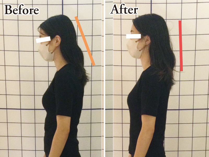 『【頭痛・腰痛専門】宇多津 鍼灸院 SHIMADA』「その痛み」、諦めないで!! 頭痛と腰痛を中心に特化した「痛みと不調」の専門鍼灸院【香川県綾歌郡宇多津町】