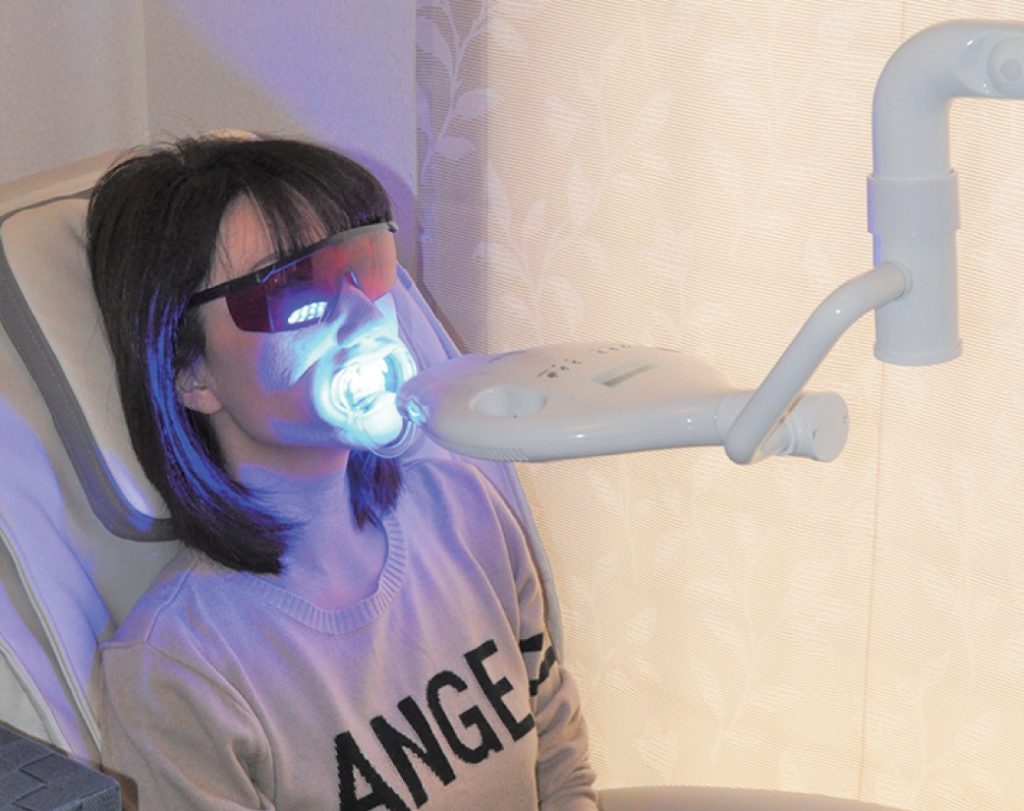 歯のホワイトニングをもっと手頃に身近に。男女ともOK!