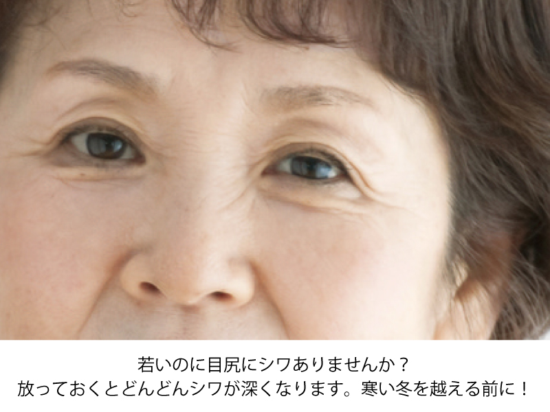 シミ・シワ・たるみ まだあきらめないで！今すぐGo