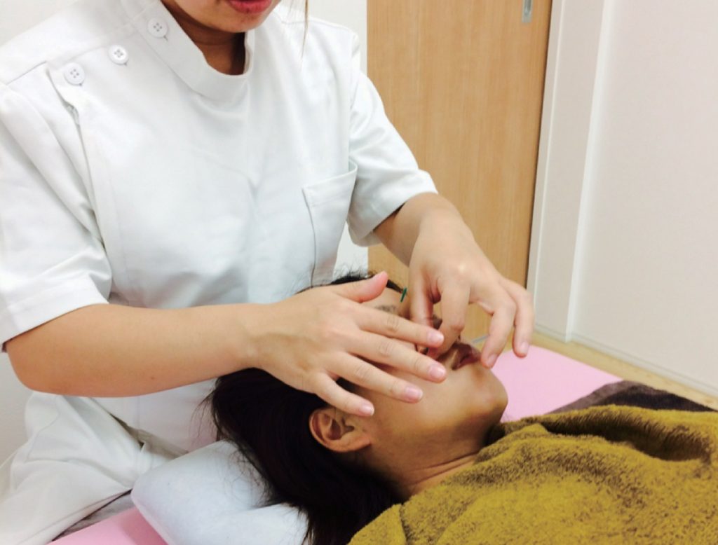 美容鍼灸でキレイ＆リフレッシュ！