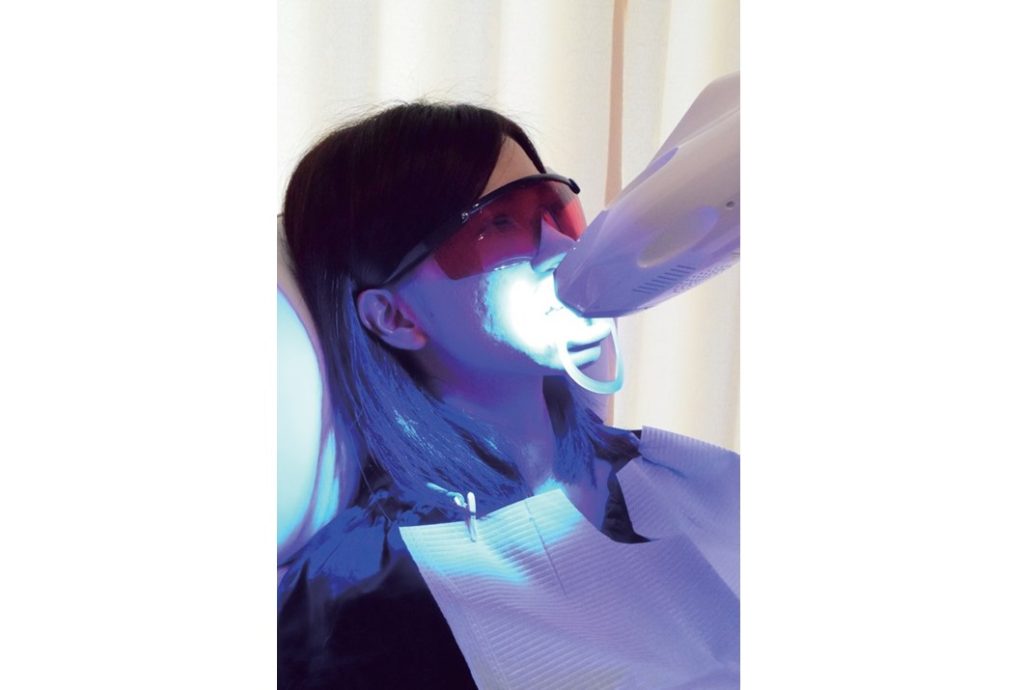 低価格で実現！笑顔が輝く真っ白な歯に！