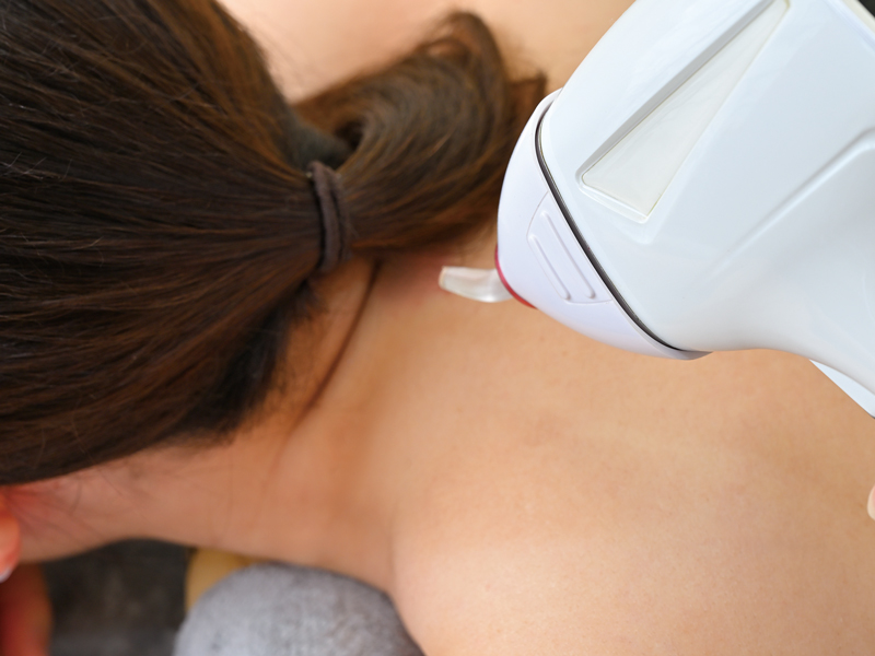 うなじのみの施術も可能