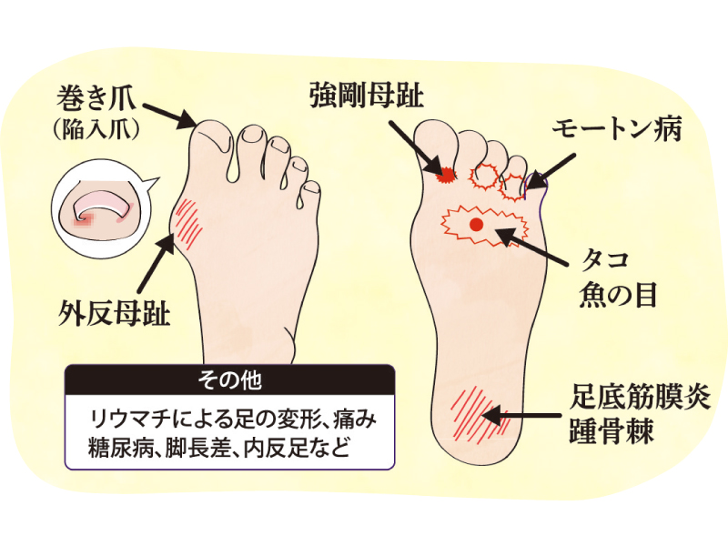 『あゆみショップ 本店』足元が変わると、生活も変わる快適な毎日を始めるなら、無料相談会へ【香川県さぬき市大川町】